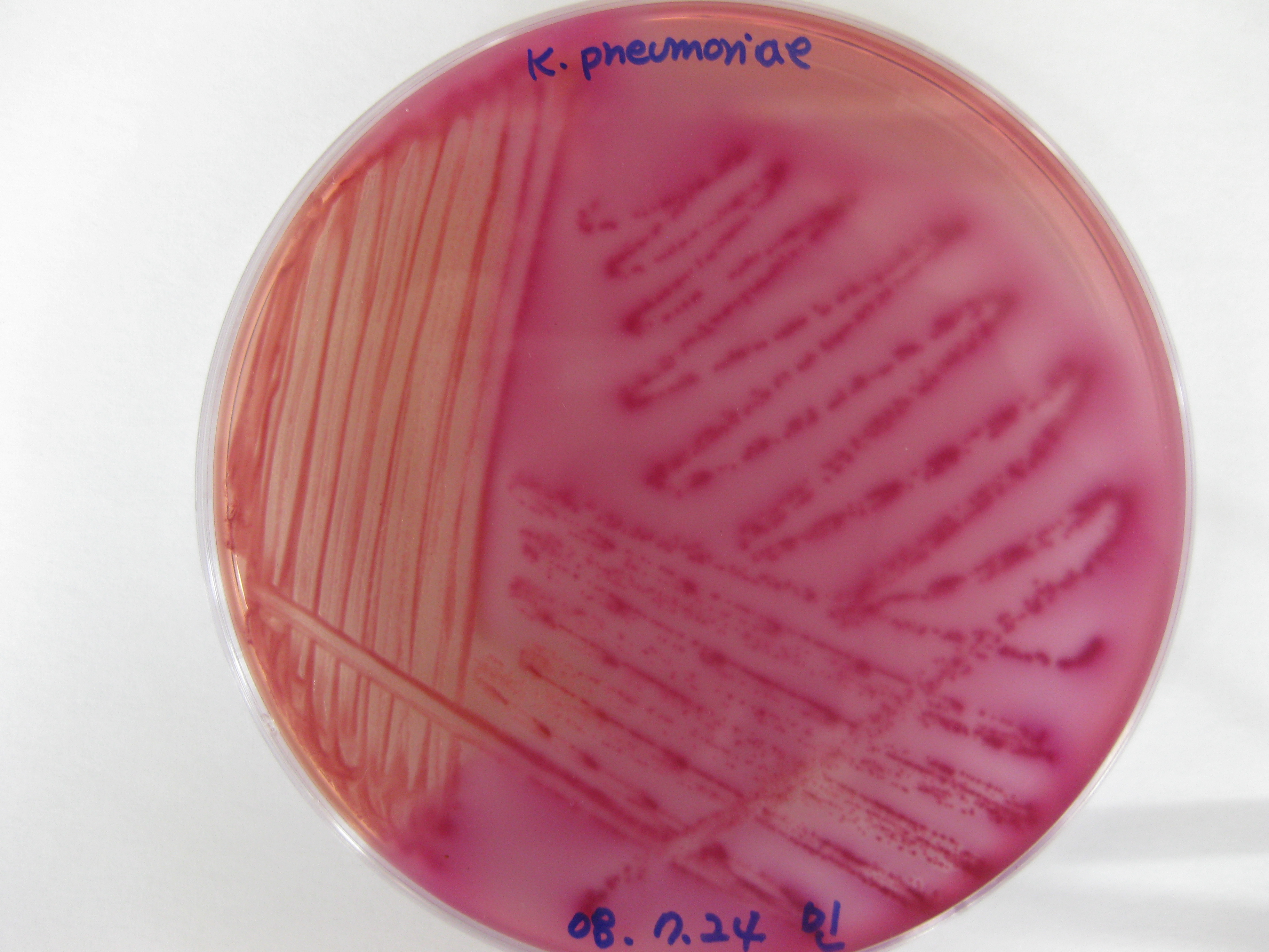 Klebsiella 1_1